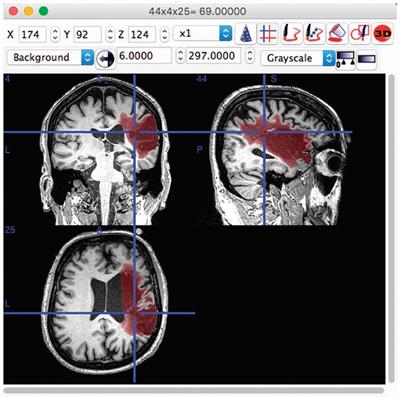 Exploring approaches to tackle cross-domain challenges in brain medical image segmentation: a systematic review